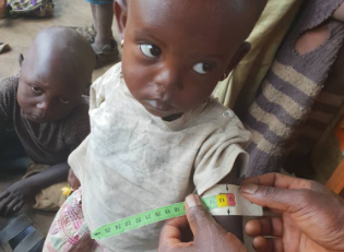 Malnutrition DR Congo
