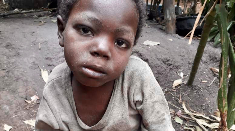 Hungersnot und Krankheit in Afrika